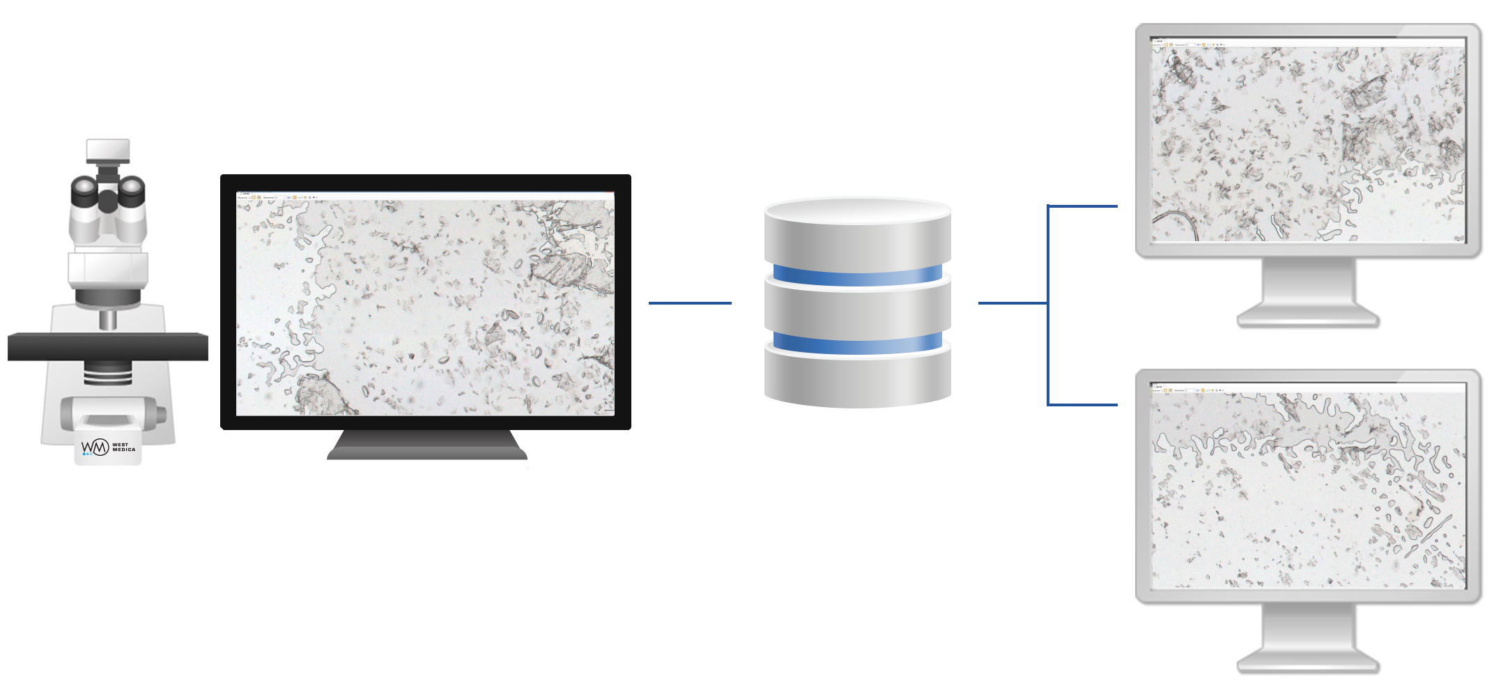 Vision Remote Vision Remote