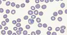 Automatic scanning with red blood cell counting