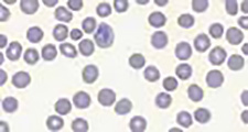 Automatic scanning with red blood cell counting