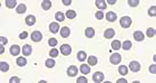 Automatic scanning with red blood cell counting