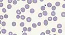Automatic scanning with red blood cell counting