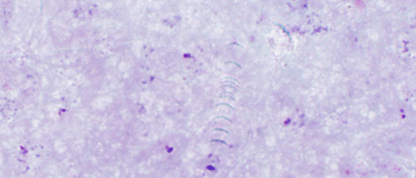 Digital thick smear preparation Digital thick smear preparation