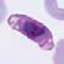 Plasmodium falciparum