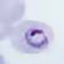 Plasmodium ovale