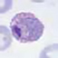 Plasmodium vivax