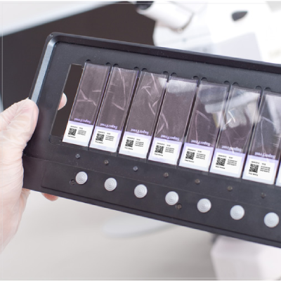 Upload the slides to the cassette.
Install the cassette into the system
and run the scan Upload the slides to the cassette.
Install the cassette into the system
and run the scan