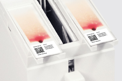Obtain a thin smear with a large working area